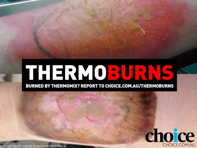 Thermoburns campaign