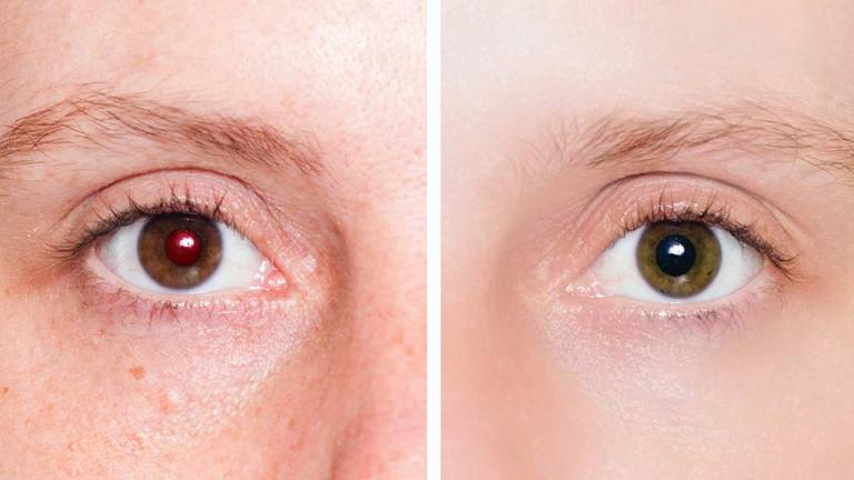 close up of face with one red eye