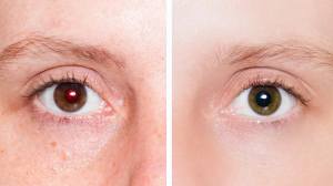 close up of face with one red eye