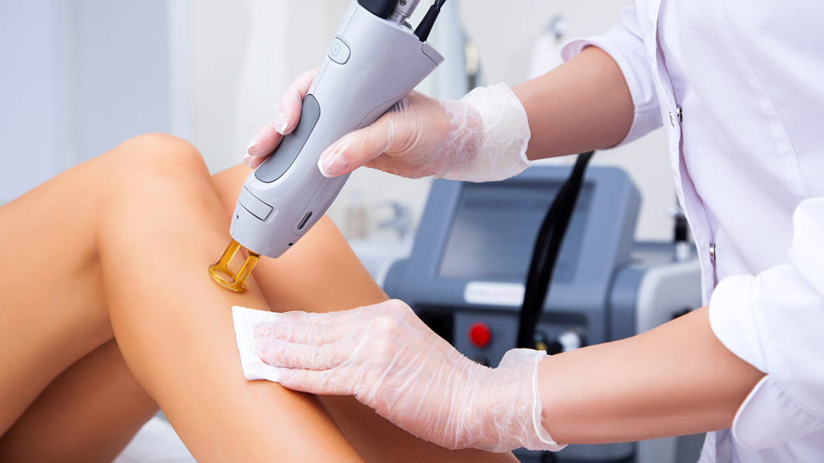 laser hair removal lead