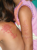 girl with henna tattoo burns